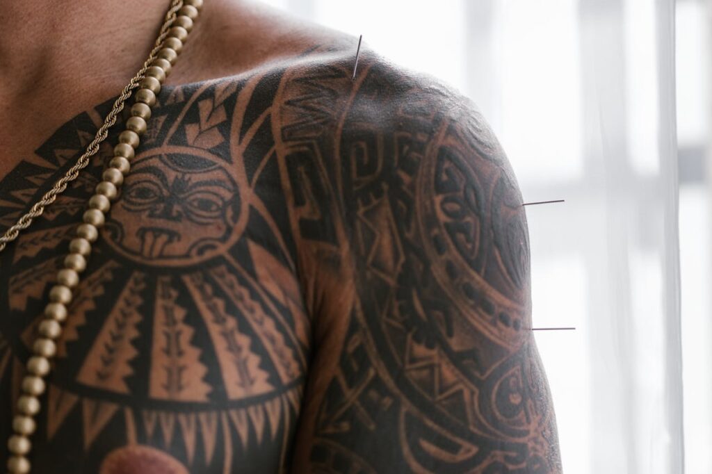 Close-up of a tattooed shoulder with acupuncture needles, showcasing alternative medicine practice.